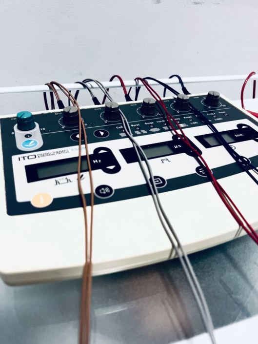 NeuromodulaciÓn-acupuntura